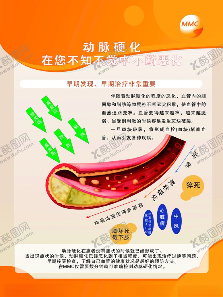 编号：89615612182121022945【酷图网】源文件下载-MMC制度牌动脉硬化