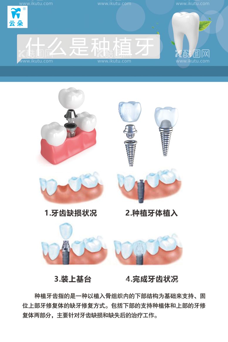 编号：35065412220522428592【酷图网】源文件下载-什么是种植牙