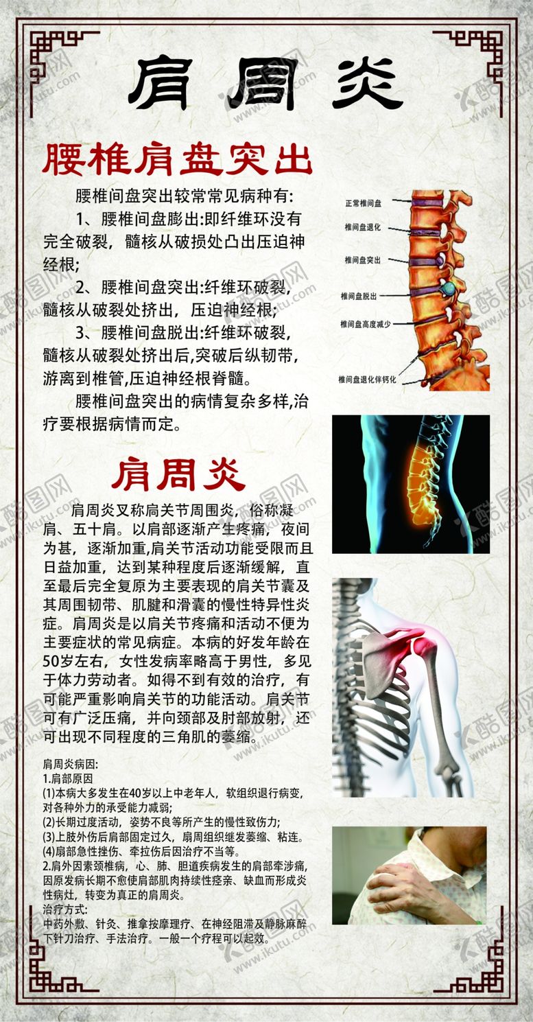 编号：76047902081053194289【酷图网】源文件下载-肩周炎