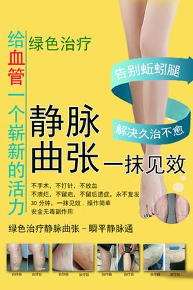 静脉曲张