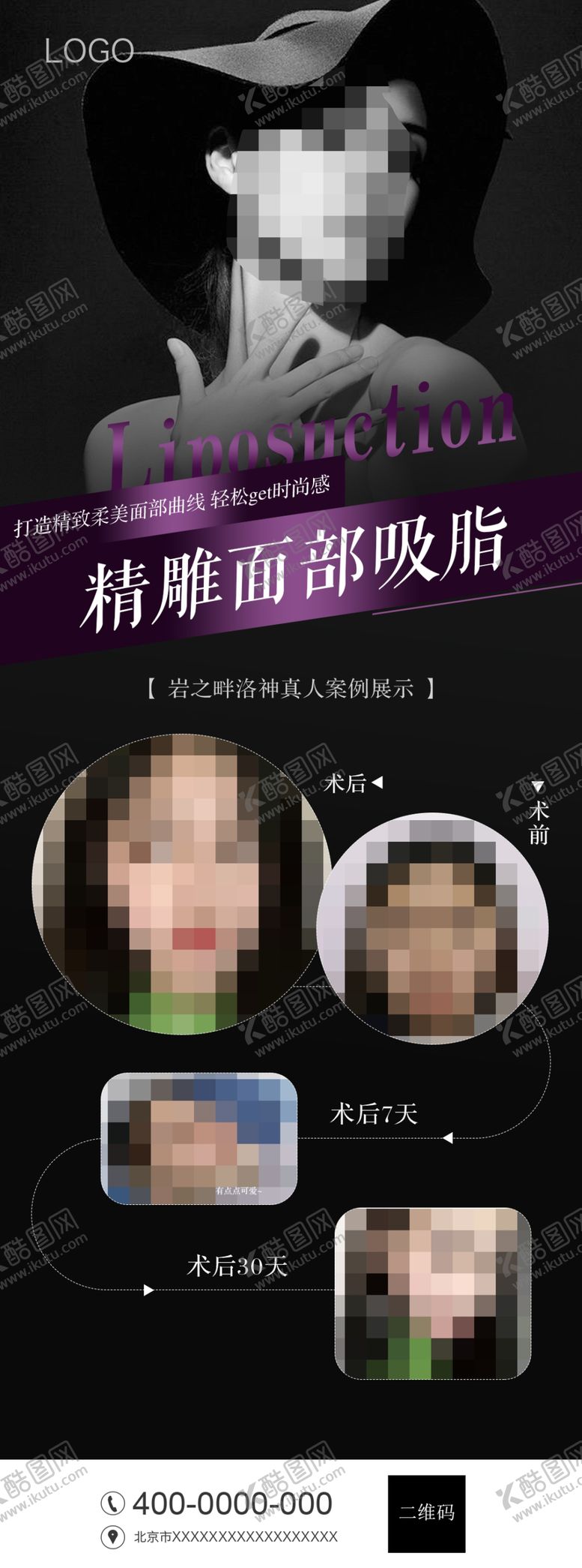 编号：24756807051220066997【酷图网】源文件下载-面部吸脂