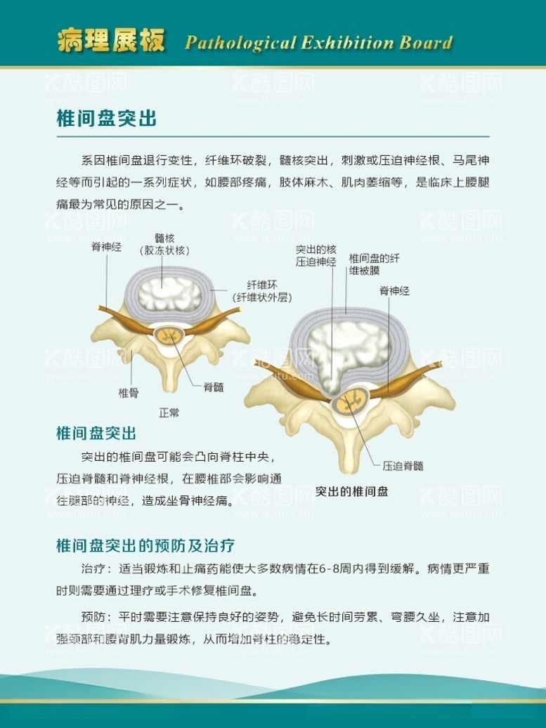 编号：40990812181851447758【酷图网】源文件下载-椎间盘突出