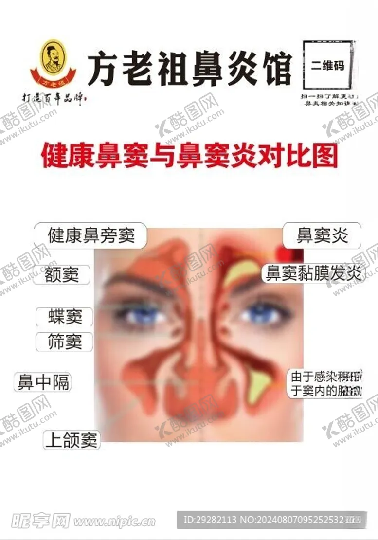编号：85551402182138453265【酷图网】源文件下载-鼻炎馆鼻窦系统结构矢量图
