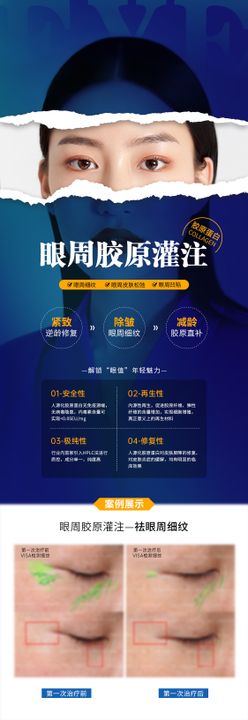 医美眼周活动海报案例