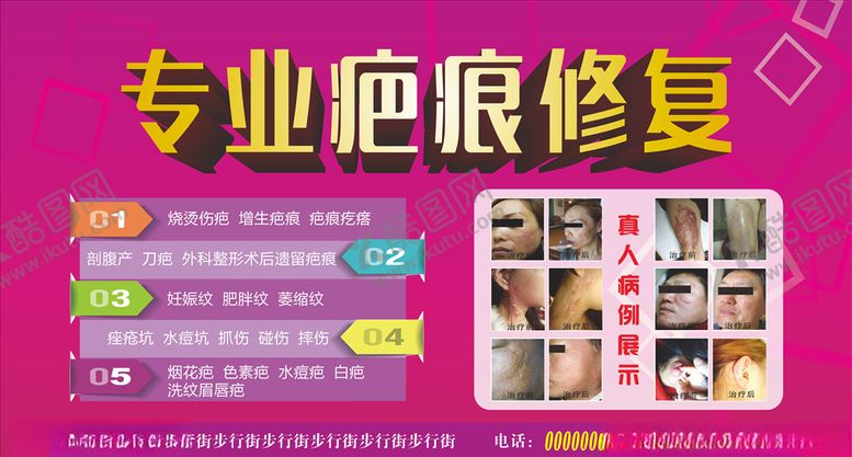 编号：16348605091404547484【酷图网】源文件下载-美容展板