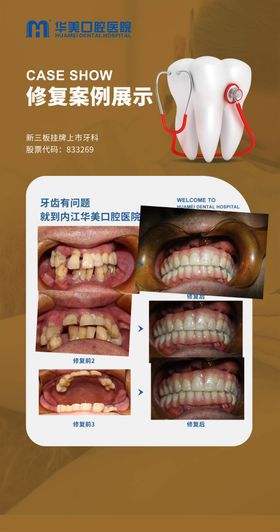 牙科修复案例展示