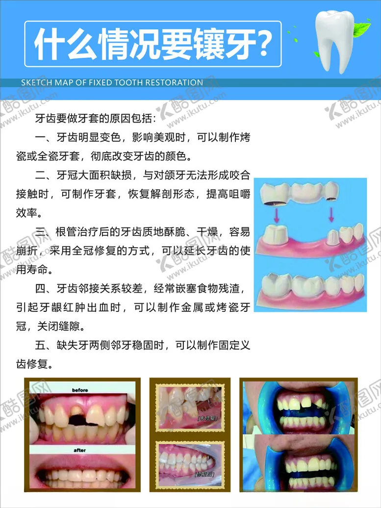 编号：48949402090313301459【酷图网】源文件下载-镶牙海报