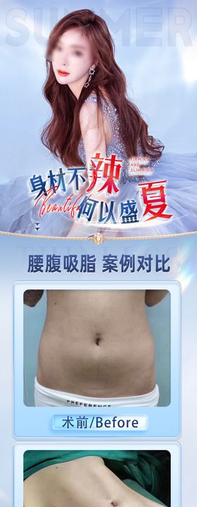 美无脂境腰腹环吸海报