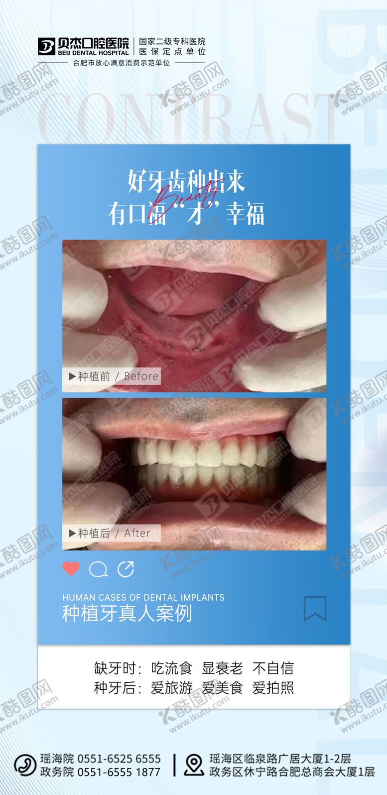 编号：81622612041440531320【酷图网】源文件下载-种植牙案例海报