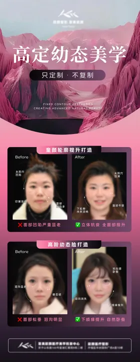 医美案例对比图展架海报