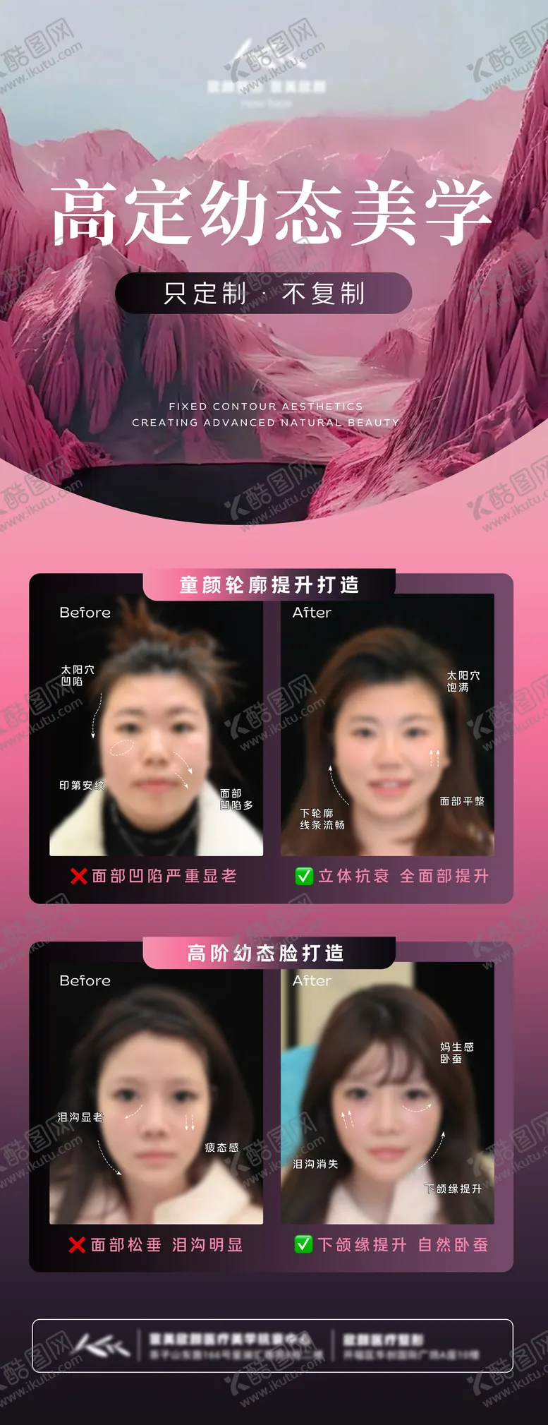 编号：73443902250400326792【酷图网】源文件下载-医美案例对比图展架海报
