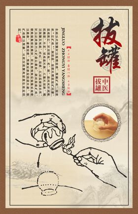 拔罐海报