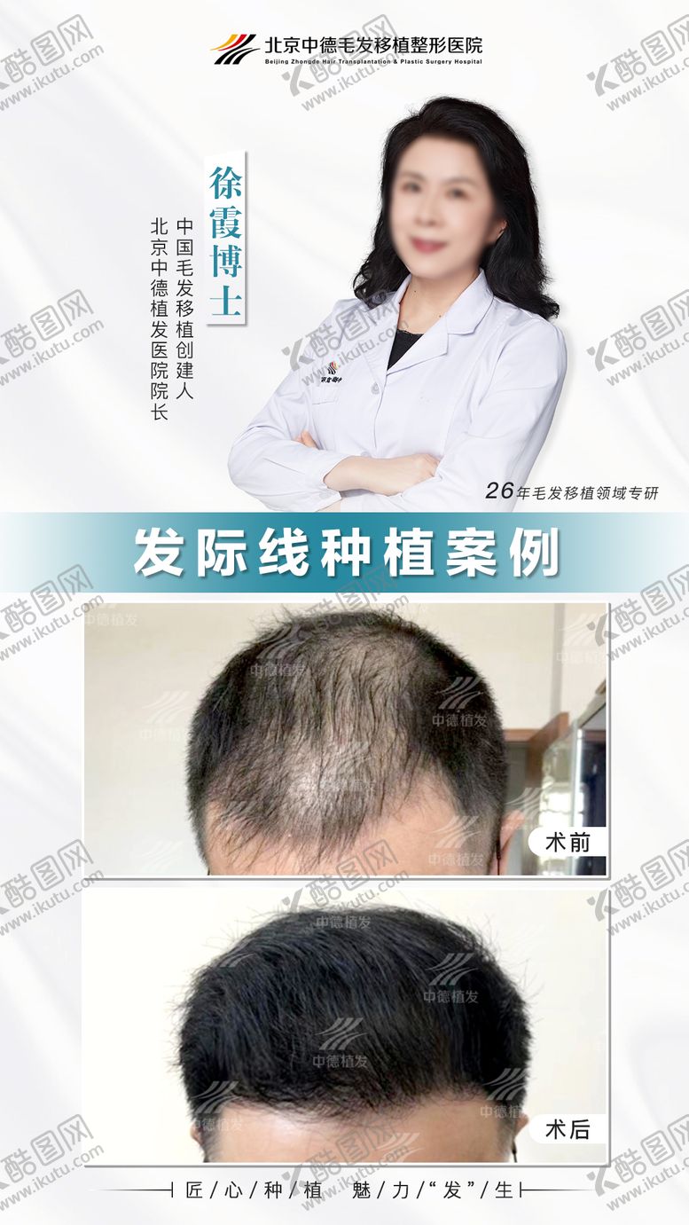 编号：21546911252043144040【酷图网】源文件下载-植发真实案例
