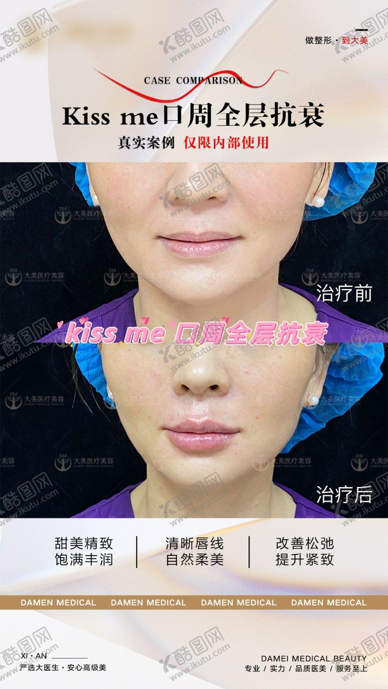编号：38502601190404295227【酷图网】源文件下载-医美案例对比