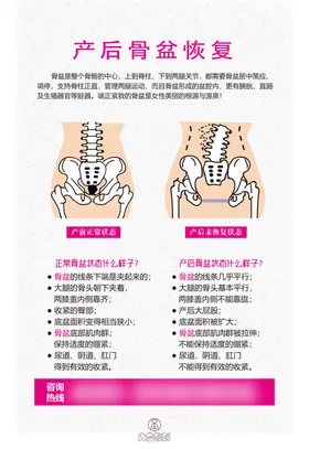 产后骨盆恢复