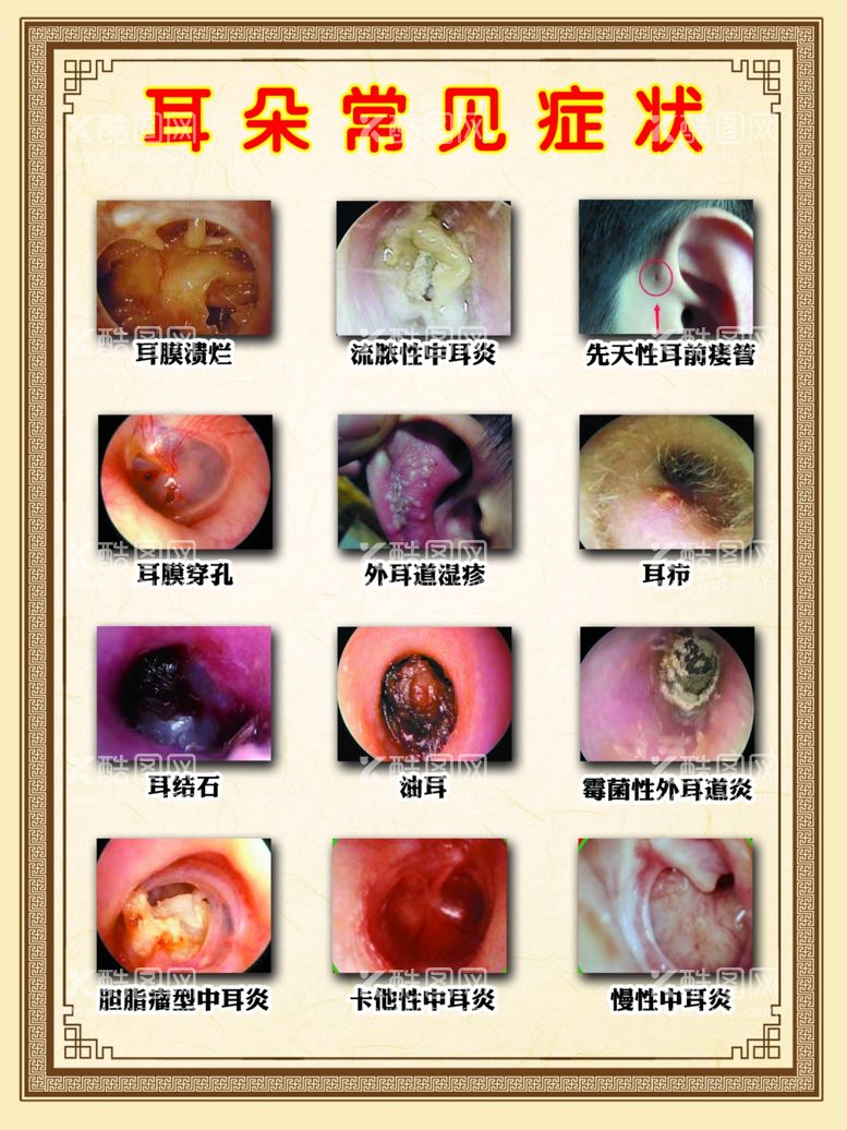 编号：68473412050553429193【酷图网】源文件下载-耳朵常见症状