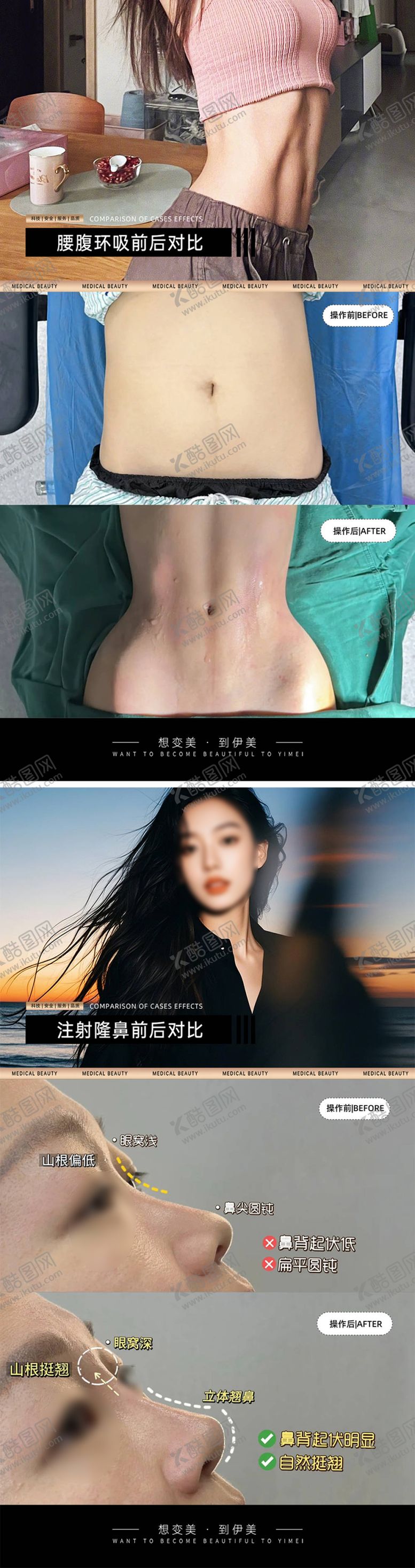 编号：59601409080700078173【酷图网】源文件下载-医美案例对比模板海报