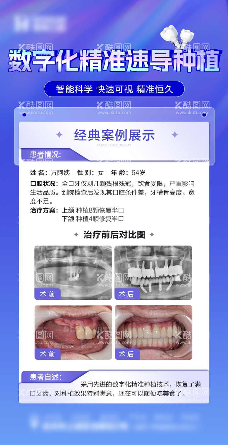 编号：69841111250851362167【酷图网】源文件下载-口腔种植牙海报