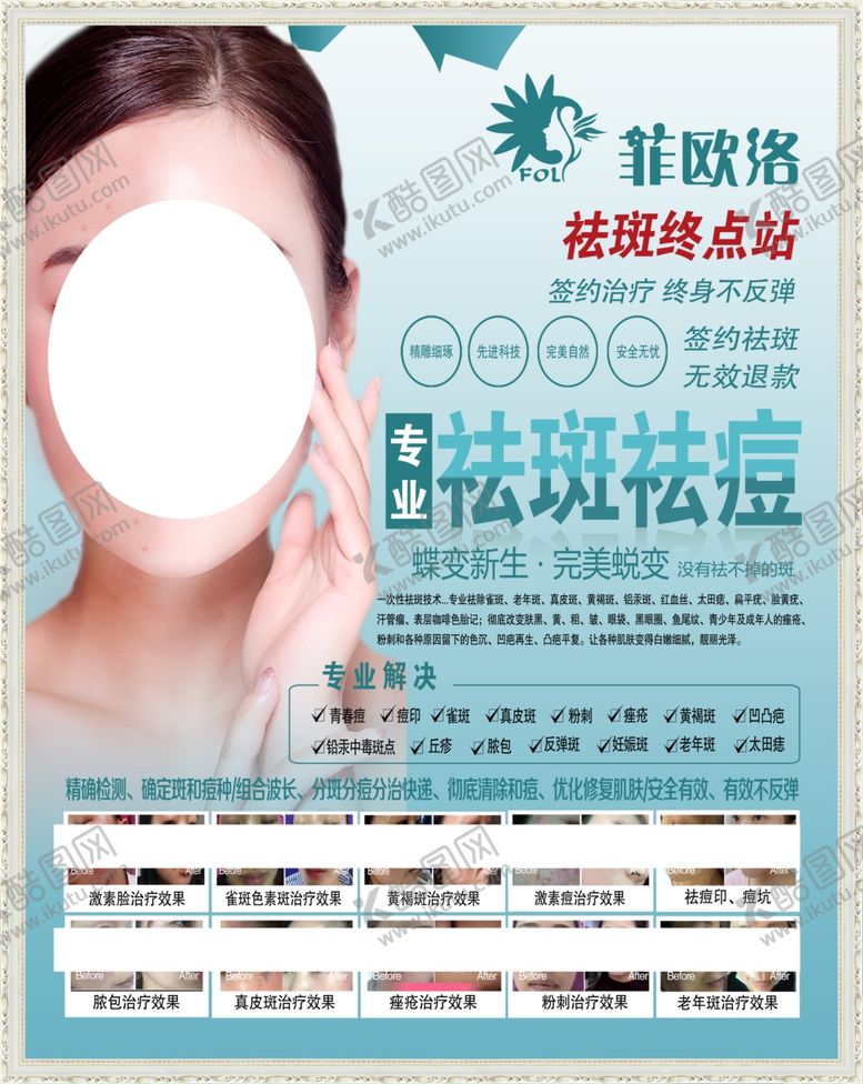 编号：70069107040218342867【酷图网】源文件下载-菲欧洛祛斑海报
