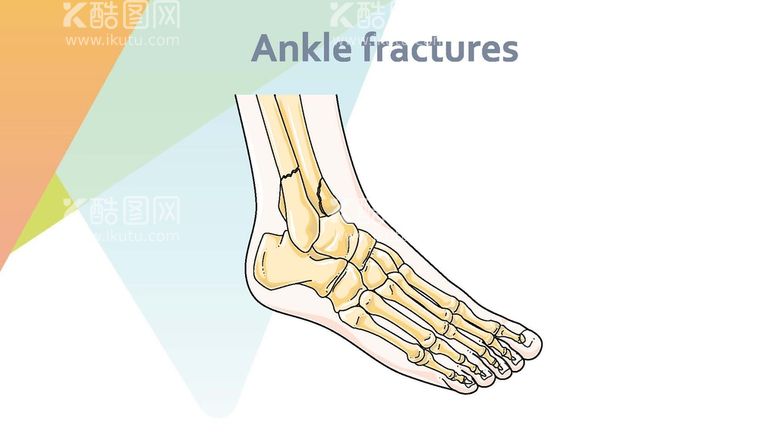 编号：49050402031305579211【酷图网】源文件下载-脚底骨骼 