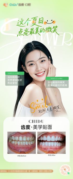 口腔美学贴面案例