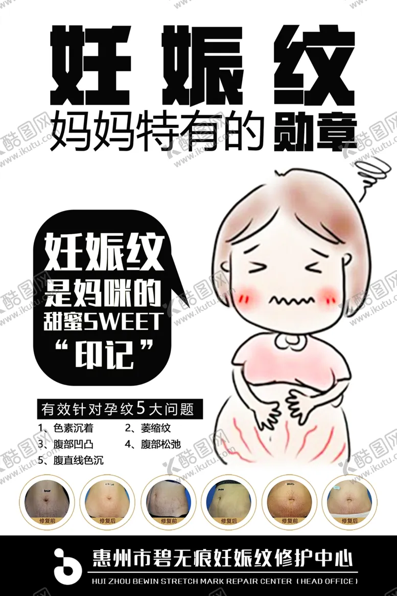 妊娠纹光圈整形广告医美整形