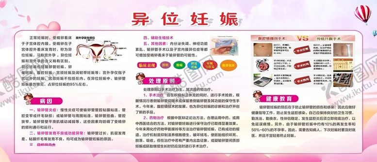 编号：42653201300613376505【酷图网】源文件下载-异位妊娠