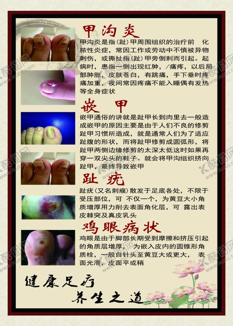 编号：15215207031725269917【酷图网】源文件下载-甲沟炎足疗