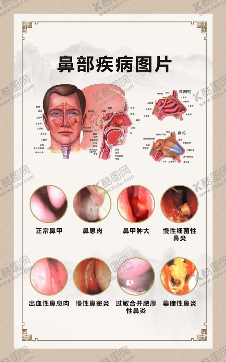 编号：42151701311443216831【酷图网】源文件下载-鼻部疾病图片