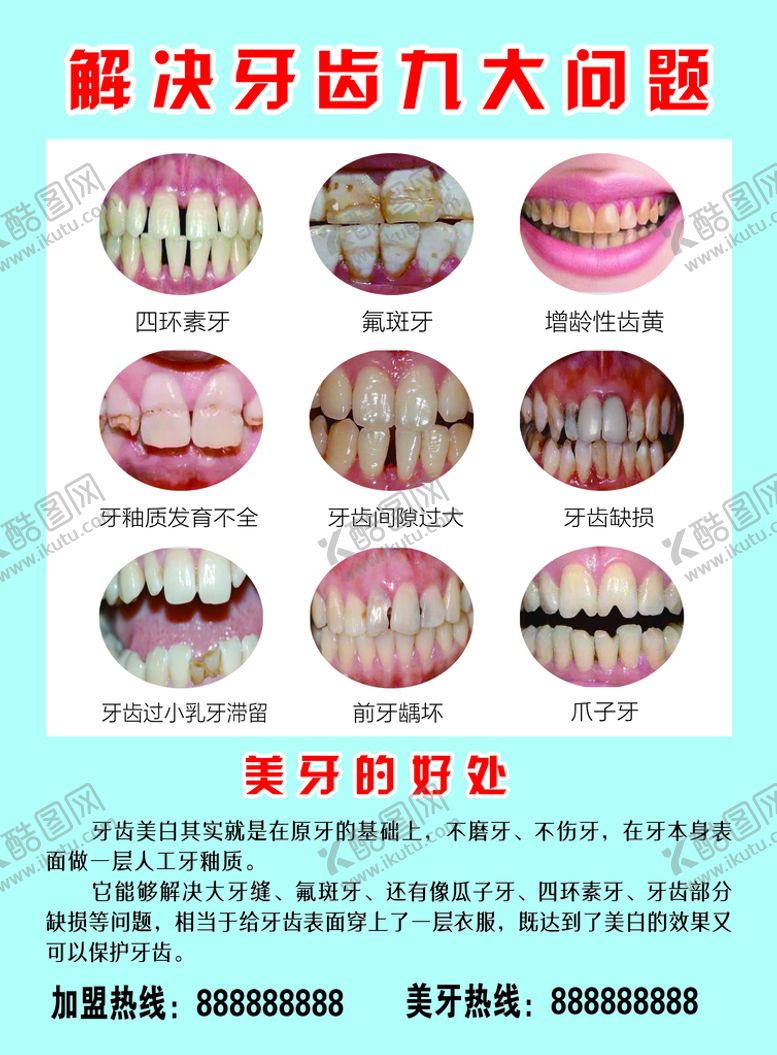 编号：92586309161953293847【酷图网】源文件下载-美牙