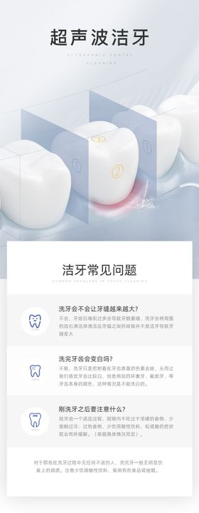 超声波洁牙口腔清洁活动长图海报