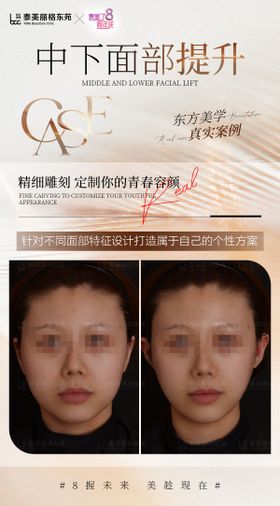 医美案例海报