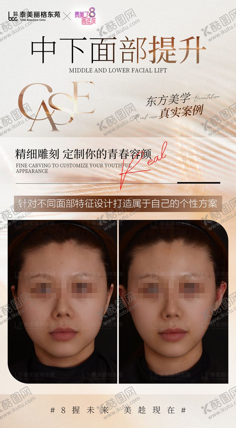 编号：38578210011702551455【酷图网】源文件下载-医美案例海报