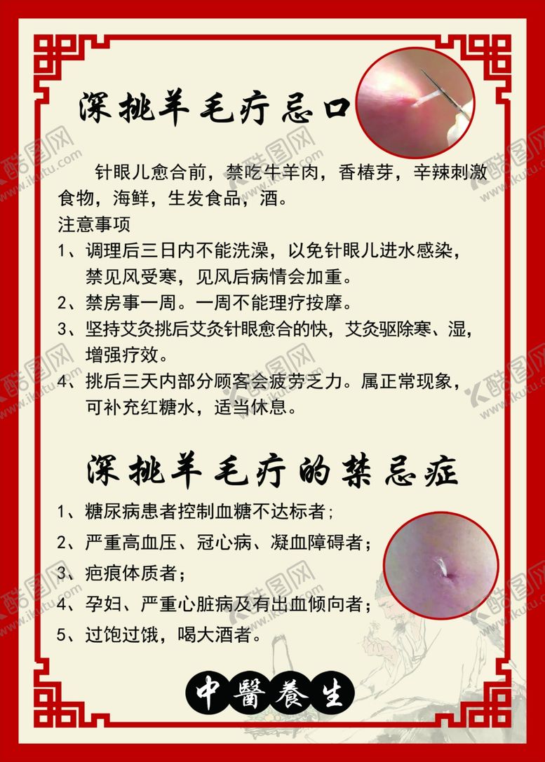 编号：97379501301622458632【酷图网】源文件下载-挑羊毛疔
