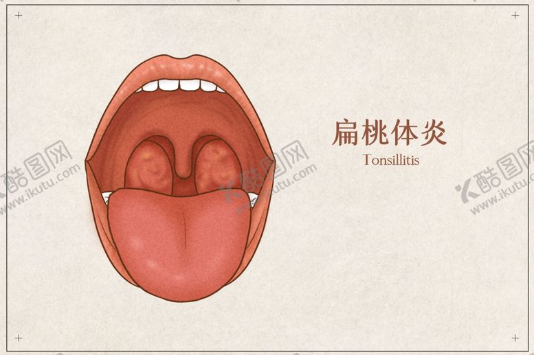 编号：28395901270351134012【酷图网】源文件下载-扁桃体炎