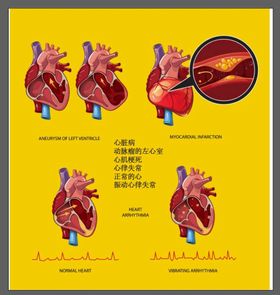 心脏医学插画