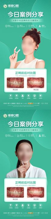 口腔矫正案例海报畸分享隐形