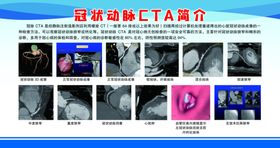 冠状动脉CTA