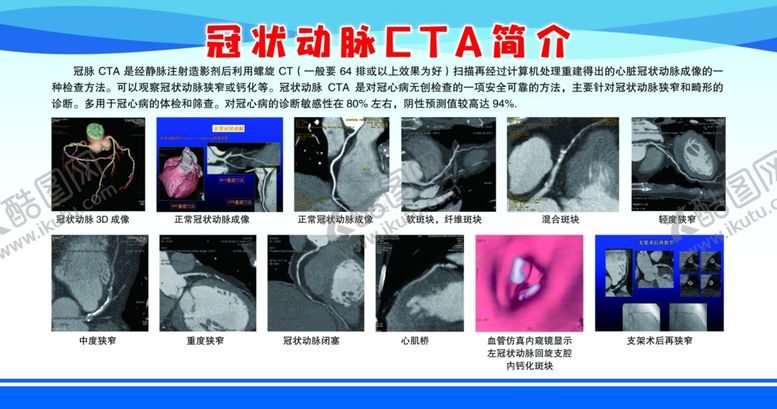 编号：73034306260539248364【酷图网】源文件下载-冠状动脉CTA