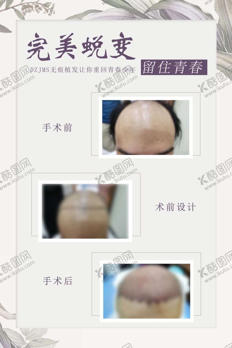 编号：27914109140355504866【酷图网】源文件下载-植发