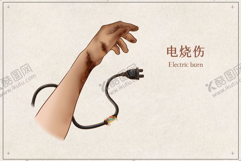 编号：09564209160008491078【酷图网】源文件下载-电烧伤