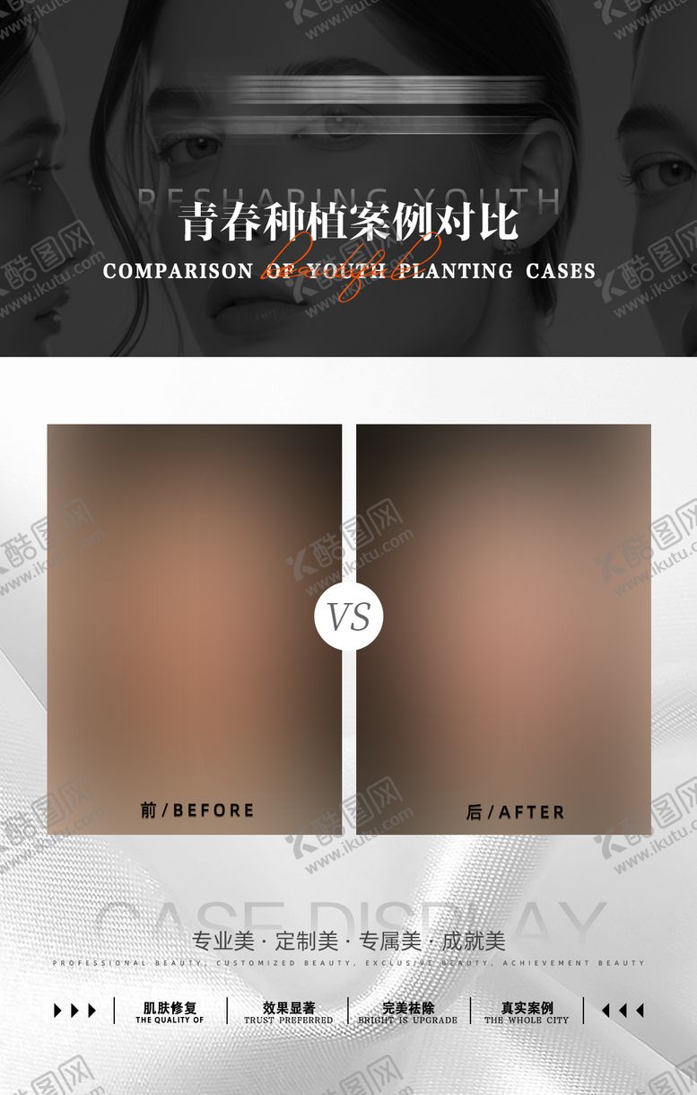 编号：32624211211444251258【酷图网】源文件下载-医美案例对比