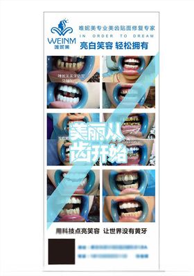 口腔图片