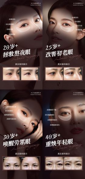 医美抗衰系列海报