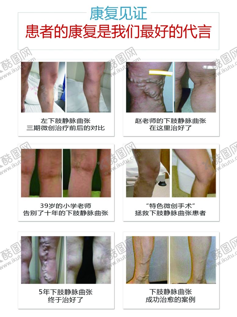 编号：50020710100848271596【酷图网】源文件下载-静脉见证