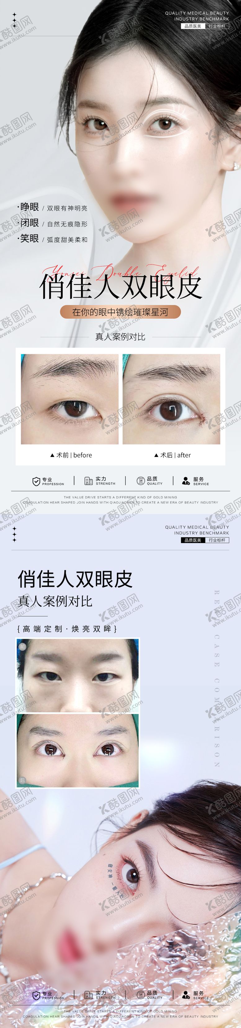 编号：95012110071728203064【酷图网】源文件下载-医美双眼皮案例系列海报