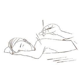 针灸