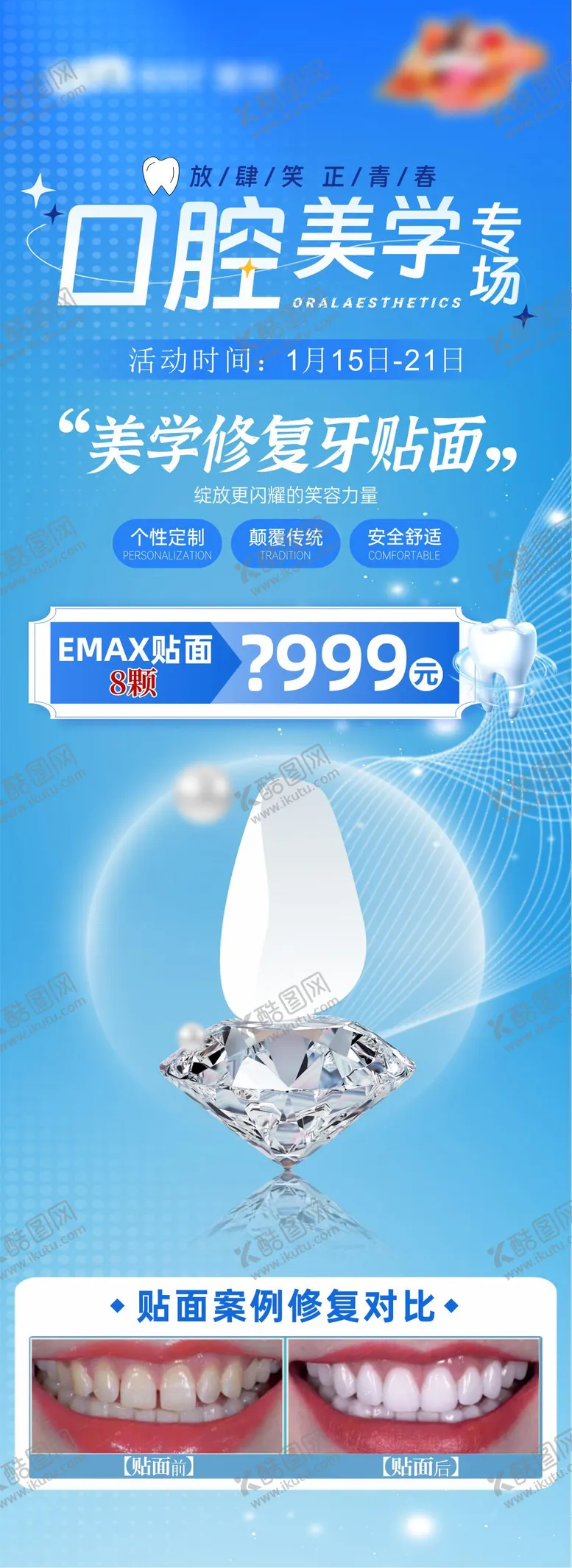 编号：52281804251949476050【酷图网】源文件下载-口腔美学牙贴面长图