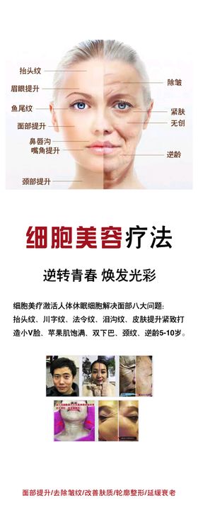 美容