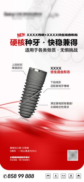 口腔牙科种植牙宣传海报